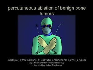 percutaneous ablation of benign bone tumors