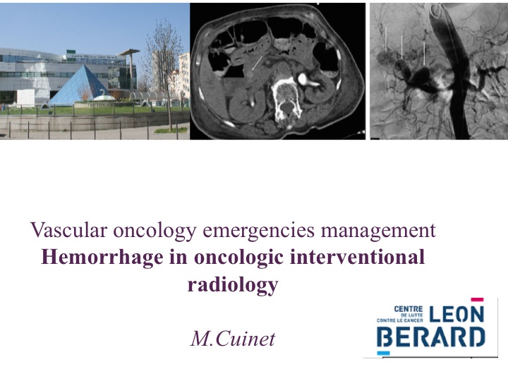 Vascular oncology emergencies managementHemorrhage in oncologic interventional radiology