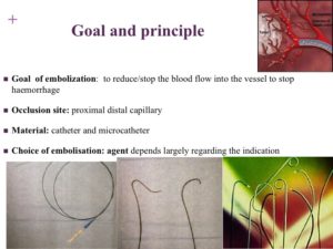 Vascular oncology emergencies managementHemorrhage in oncologic interventional radiology