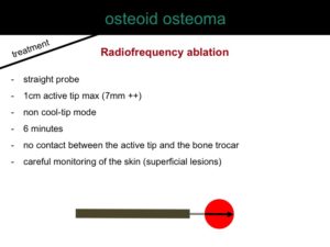 percutaneous ablation of benign bone tumors