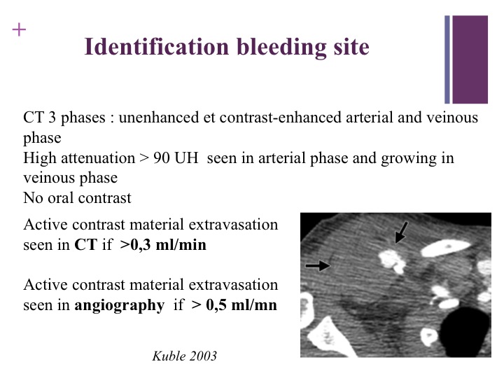 Vascular oncology emergencies managementHemorrhage in oncologic interventional radiology