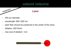 percutaneous ablation of benign bone tumors
