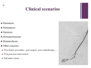 Vascular oncology emergencies managementHemorrhage in oncologic interventional radiology