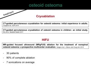 percutaneous ablation of benign bone tumors