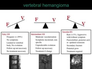 percutaneous ablation of benign bone tumors