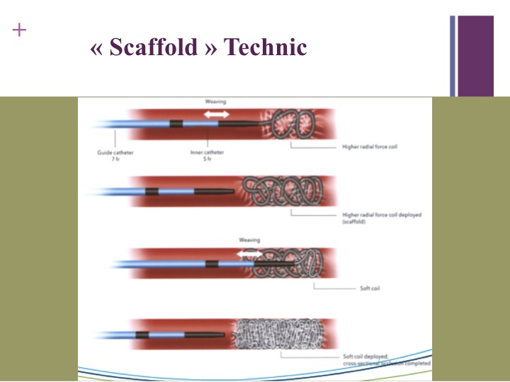 Vascular oncology emergencies managementHemorrhage in oncologic interventional radiology