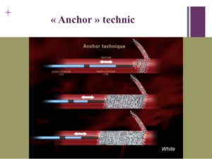 Vascular oncology emergencies managementHemorrhage in oncologic interventional radiology