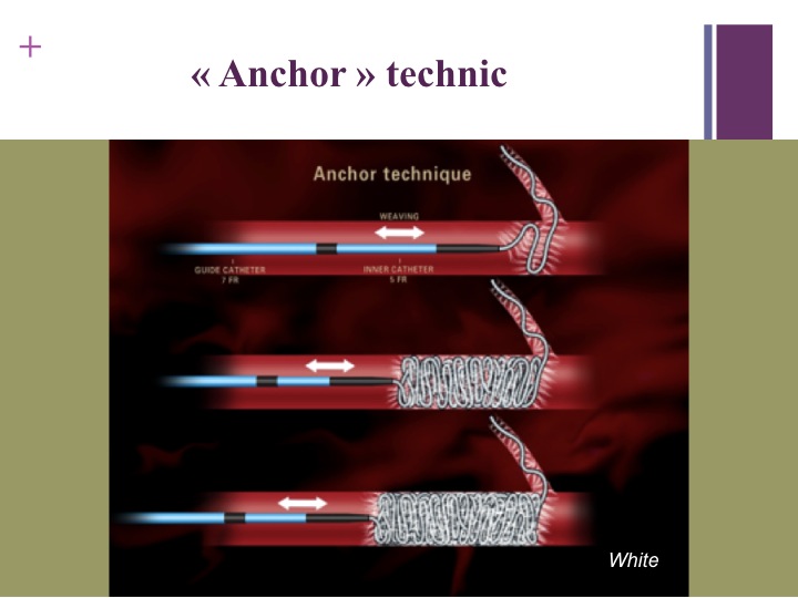 Vascular oncology emergencies managementHemorrhage in oncologic interventional radiology