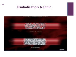 Vascular oncology emergencies managementHemorrhage in oncologic interventional radiology