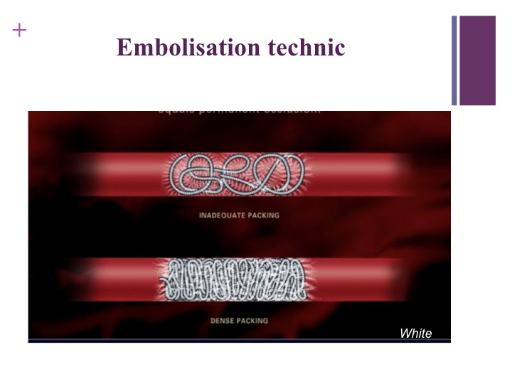 Vascular oncology emergencies managementHemorrhage in oncologic interventional radiology