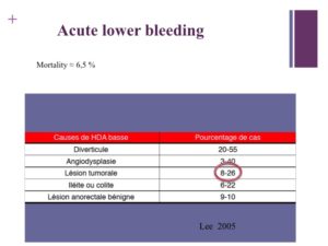 Vascular oncology emergencies managementHemorrhage in oncologic interventional radiology