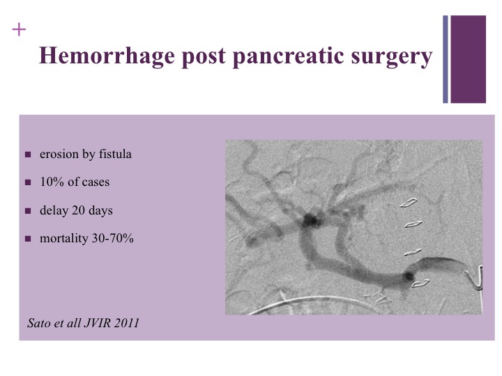Vascular oncology emergencies managementHemorrhage in oncologic interventional radiology