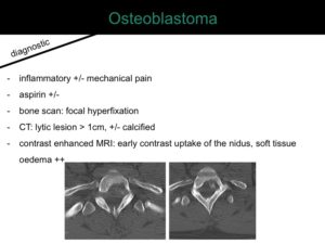 percutaneous ablation of benign bone tumors