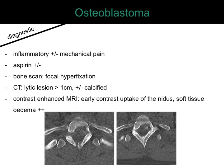 percutaneous ablation of benign bone tumors