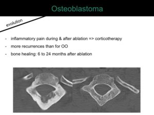 percutaneous ablation of benign bone tumors
