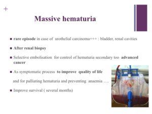 Vascular oncology emergencies managementHemorrhage in oncologic interventional radiology