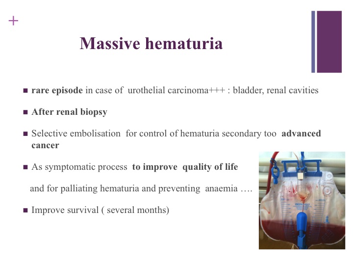Vascular oncology emergencies managementHemorrhage in oncologic interventional radiology