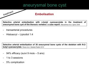 percutaneous ablation of benign bone tumors