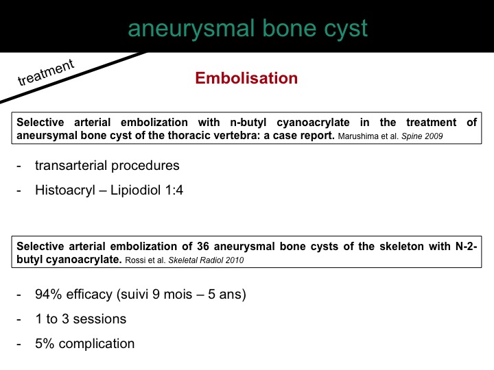 percutaneous ablation of benign bone tumors