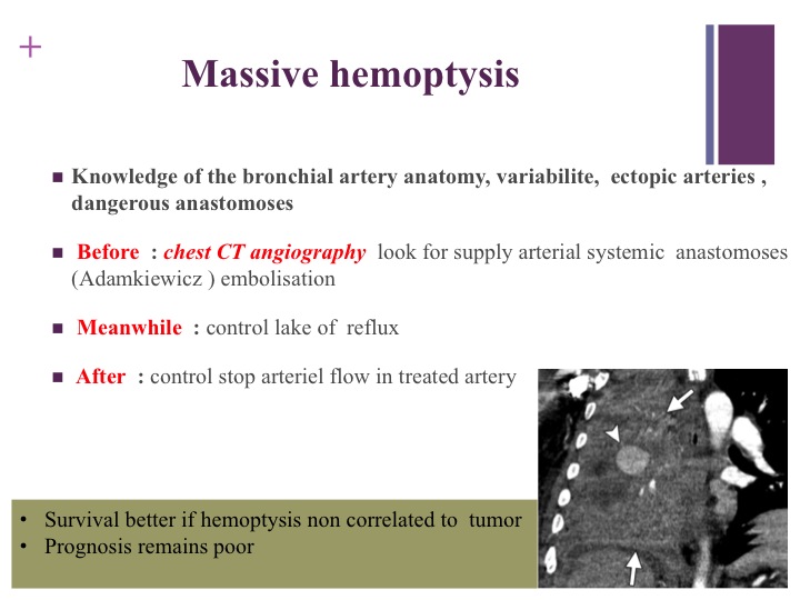 Vascular oncology emergencies managementHemorrhage in oncologic interventional radiology