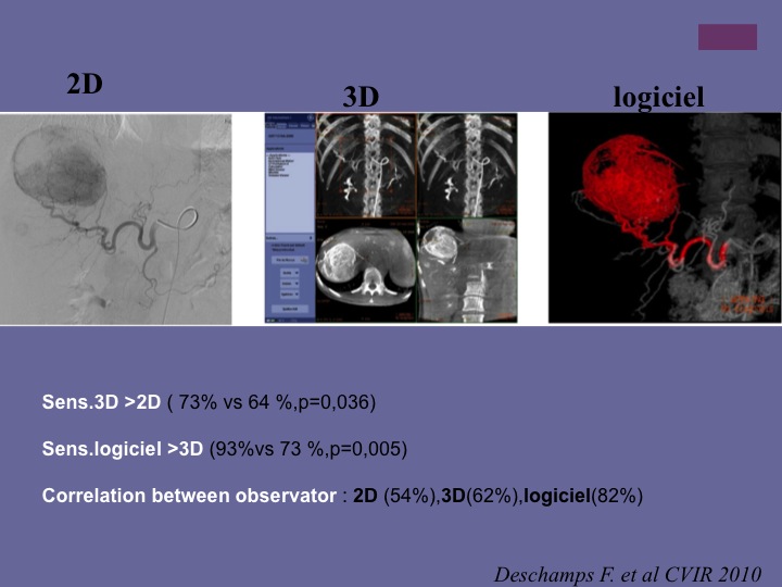 Vascular oncology emergencies managementHemorrhage in oncologic interventional radiology