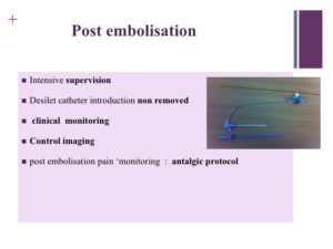 Vascular oncology emergencies managementHemorrhage in oncologic interventional radiology
