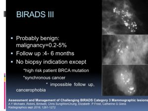 Breast Open Surgery without prior Biopsy : Still Available?