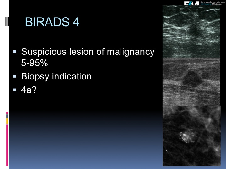 Breast Open Surgery without prior Biopsy : Still Available?
