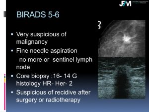 Breast Open Surgery without prior Biopsy : Still Available?