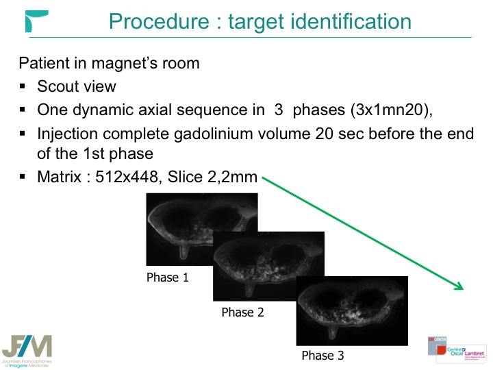 Breast MRI Interventional JFIM Mumbai 2016
