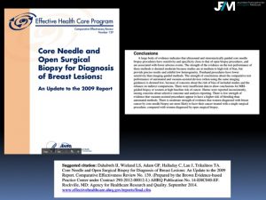 Breast Open Surgery without prior Biopsy : Still Available?