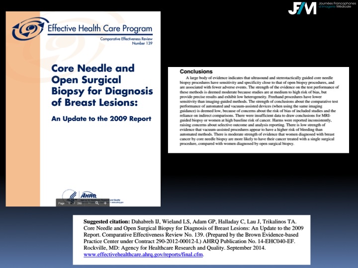 Breast Open Surgery without prior Biopsy : Still Available?