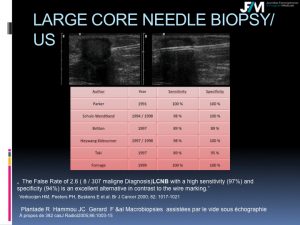 Breast Open Surgery without prior Biopsy : Still Available?