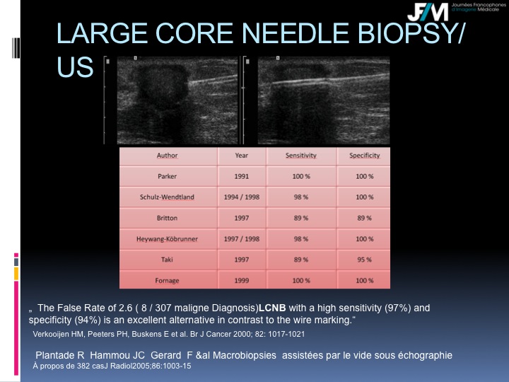 Breast Open Surgery without prior Biopsy : Still Available?