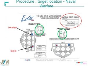 Breast MRI Interventional JFIM Mumbai 2016