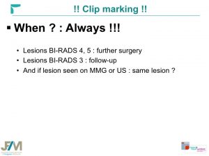 Breast MRI Interventional JFIM Mumbai 2016