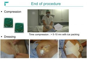 Breast MRI Interventional JFIM Mumbai 2016
