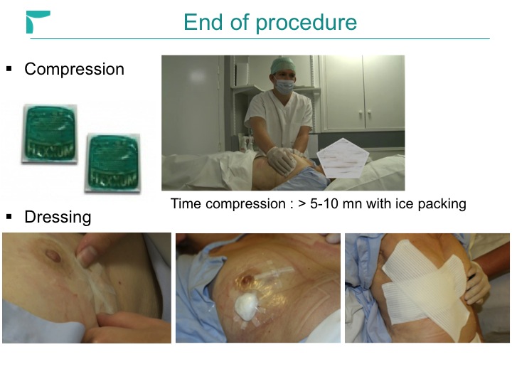 Breast MRI Interventional JFIM Mumbai 2016