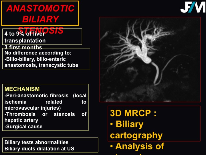 Diapositive11