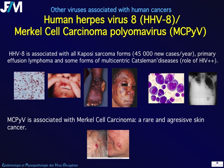 Infectious Agents and Cancers:Prevalence and Importance in Public Health in India.