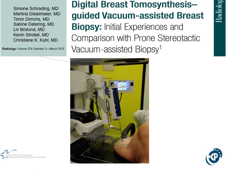 Percutaneous Breast lesion Ablation: When avoid Open Surgery?