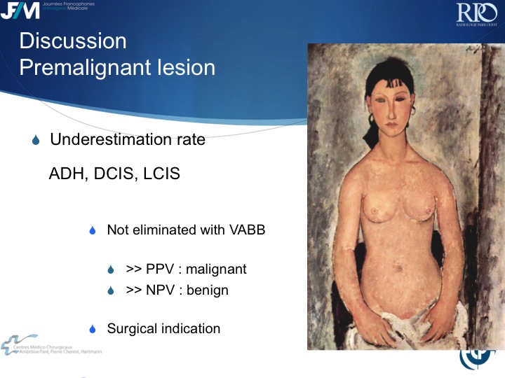 Percutaneous Breast lesion Ablation: When avoid Open Surgery?