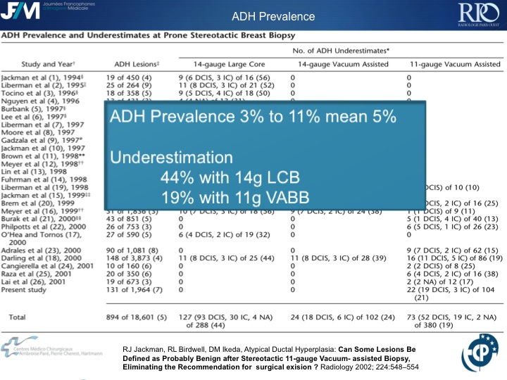 Percutaneous Breast lesion Ablation: When avoid Open Surgery?