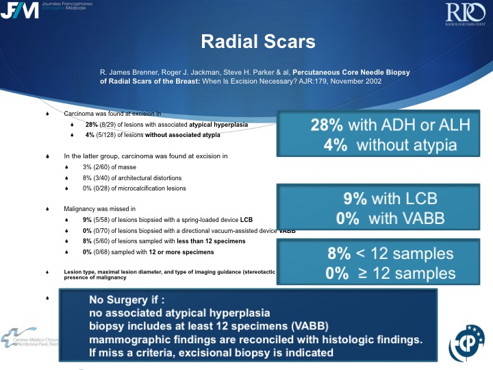 Percutaneous Breast lesion Ablation: When avoid Open Surgery?