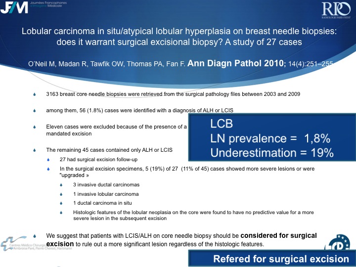 Percutaneous Breast lesion Ablation: When avoid Open Surgery?