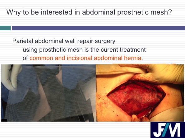 CT findings after abdominal wall repair surgery