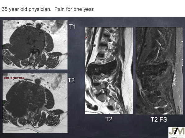 Mistakes in diagnosing of a Bone Tumor