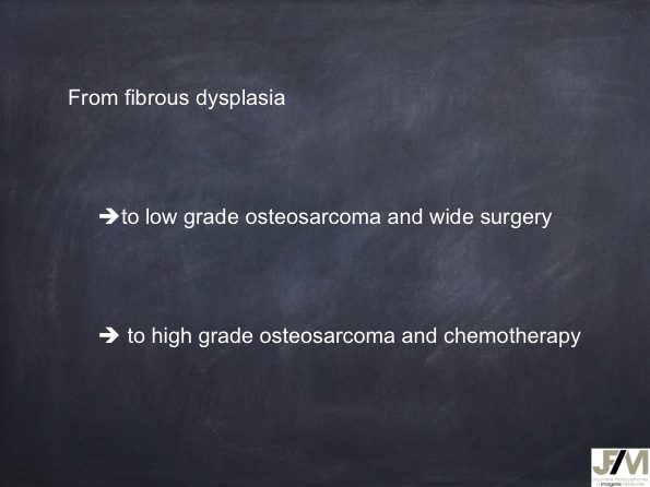 Mistakes in diagnosing of a Bone Tumor