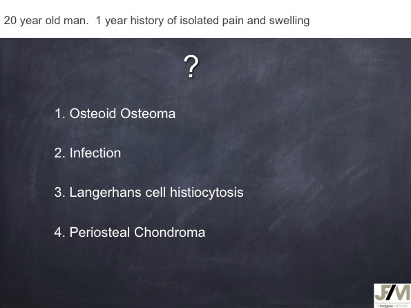 Mistakes in diagnosing of a Bone Tumor