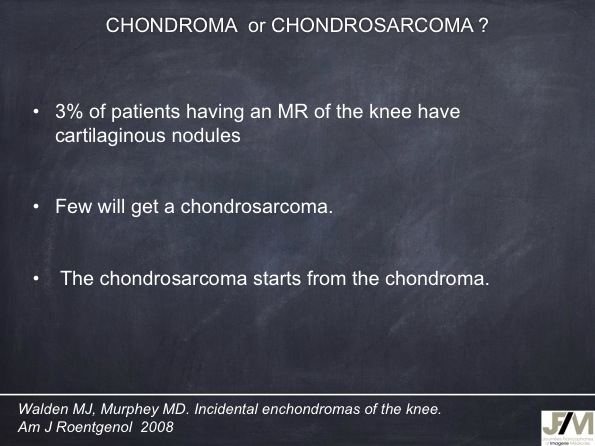 Mistakes in diagnosing of a Bone Tumor